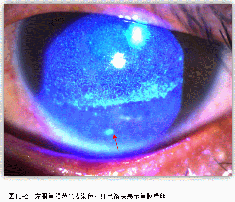 ZY016_52_2.gif
